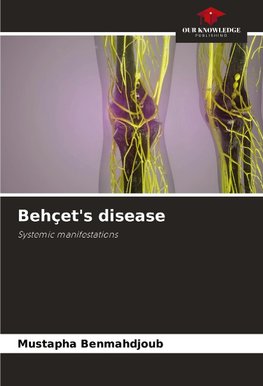 Behçet's disease