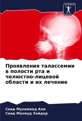 Proqwleniq talassemii w polosti rta i chelüstno-licewoj oblasti i ih lechenie