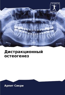 Distrakcionnyj osteogenez