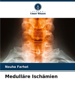 Medulläre Ischämien