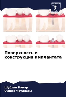 Powerhnost' i konstrukciq implantata