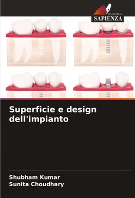 Superficie e design dell'impianto