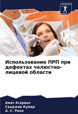 Ispol'zowanie PRP pri defektah chelüstno-licewoj oblasti