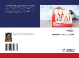 IMPLANT OCCLUSION