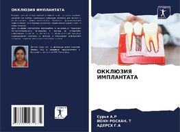 OKKLJuZIYa IMPLANTATA