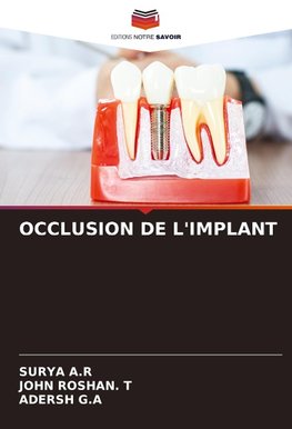 OCCLUSION DE L'IMPLANT