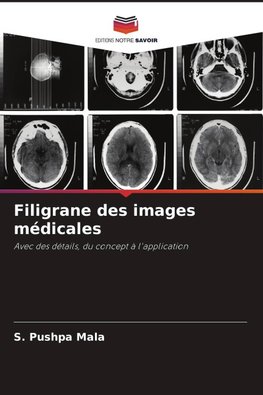 Filigrane des images médicales