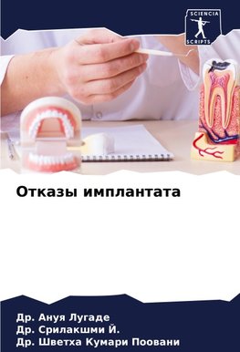 Otkazy implantata