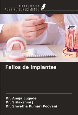 Fallos de implantes