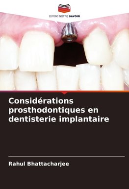 Considérations prosthodontiques en dentisterie implantaire