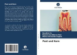 Post und Kern