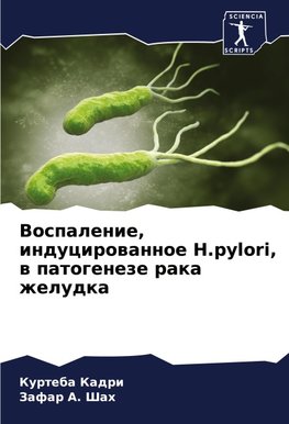 Vospalenie, inducirowannoe H.pylori, w patogeneze raka zheludka