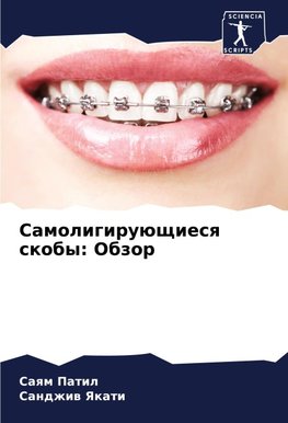 Samoligiruüschiesq skoby: Obzor