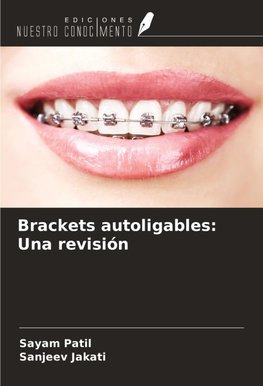 Brackets autoligables: Una revisión