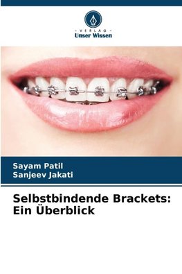 Selbstbindende Brackets: Ein Überblick