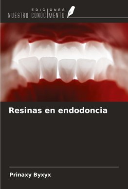 Resinas en endodoncia