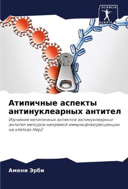 Atipichnye aspekty antinuklearnyh antitel