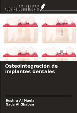 Osteointegración de implantes dentales