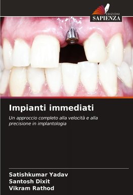 Impianti immediati