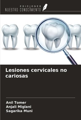 Lesiones cervicales no cariosas