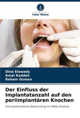 Der Einfluss der Implantatanzahl auf den periimplantären Knochen