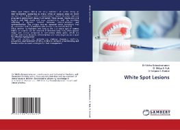 White Spot Lesions