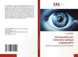 Tomographie par cohérence optique angiographie