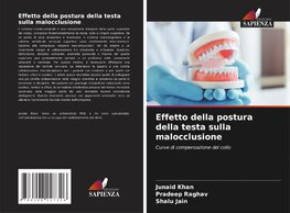 Effetto della postura della testa sulla malocclusione