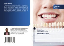 Shade Selection
