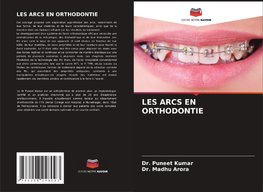 LES ARCS EN ORTHODONTIE