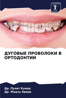 DUGOVYE PROVOLOKI V ORTODONTII