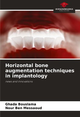 Horizontal bone augmentation techniques in implantology