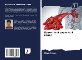 Patentnyj owal'nyj kanal