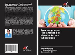 Agar sangue per l'isolamento del Mycobacterium tuberculosis