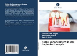 Ridge-Enhancement in der Implantattherapie