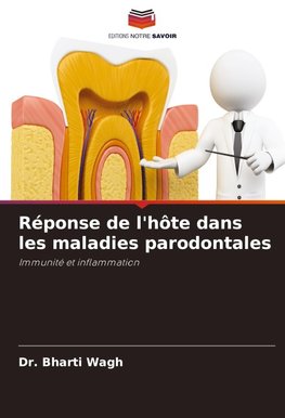 Réponse de l'hôte dans les maladies parodontales