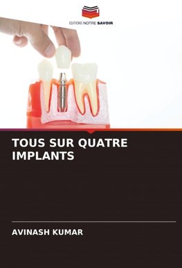 TOUS SUR QUATRE IMPLANTS