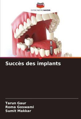 Succès des implants