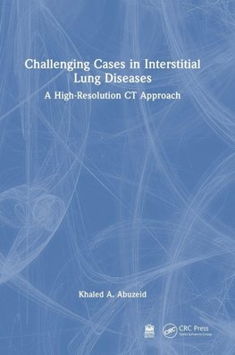 Challenging Cases in Interstitial Lung Diseases