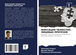 FIKSACIYa ChELJuSTNO-LICEVYH PROTEZOV