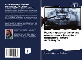 Radiomorfometricheskie pokazateli u bezzubyh pacientow: Obzor literatury