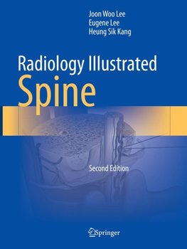 Radiology Illustrated: Spine