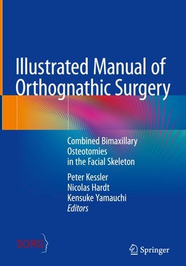 Illustrated Manual of Orthognathic Surgery