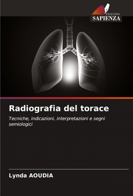 Radiografia del torace