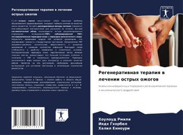 Regeneratiwnaq terapiq w lechenii ostryh ozhogow