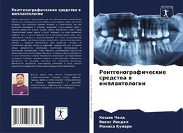 Rentgenograficheskie sredstwa w implantologii