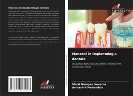 Monconi in implantologia dentale