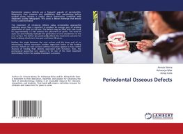 Periodontal Osseous Defects
