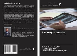 Radiología torácica