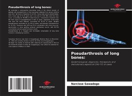 Pseudarthrosis of long bones: